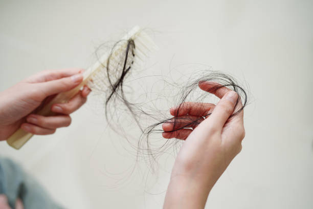 Kerontokan Rambut